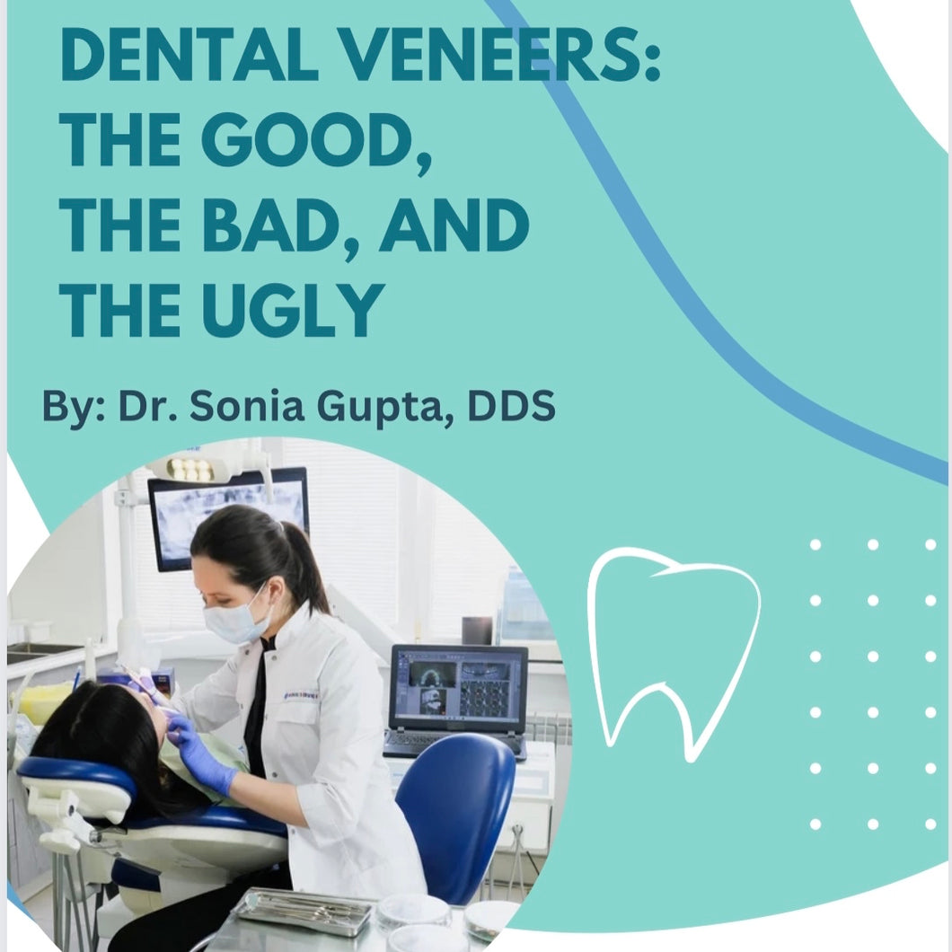 Dental Veneers: The Good, The Bad, and the Ugly by Dr. Gupta - E-Book